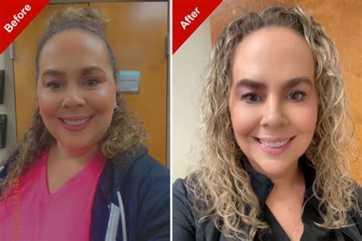 Unveiling The Transformative Power Of Before And After Photos