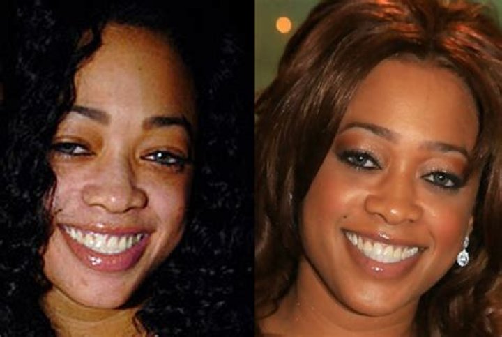 Celebrities Who Transformed Their Skin