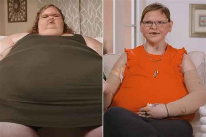 Unbelievable Transformation: Cindy's Journey To Overcome 600 Pounds