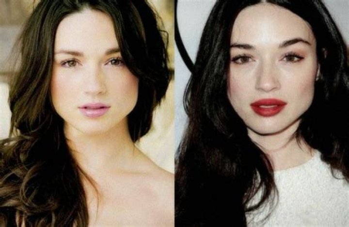 Crystal Reed's Plastic Surgery Journey