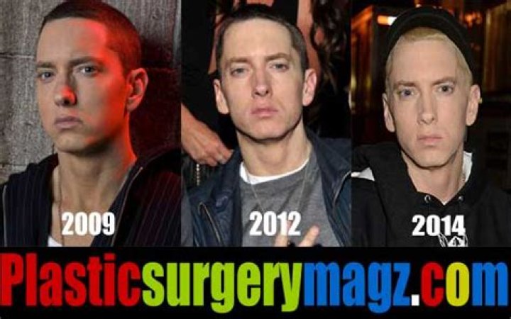 Eminem's Plastic Surgery: Uncovering The Truth