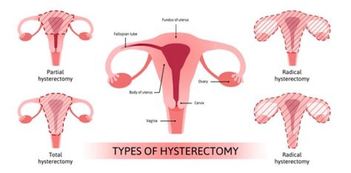 Melissa Camp's Hysterectomy: Was It Done?