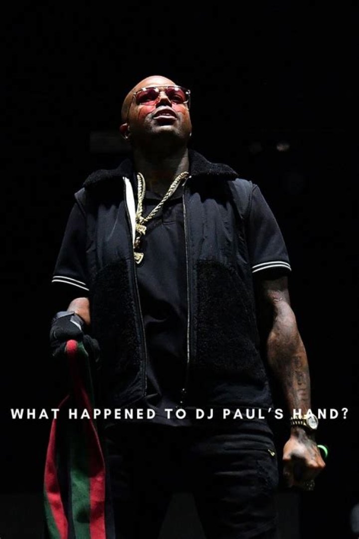 Dj Paul hand, What Happened to Dj Pauls Hand?