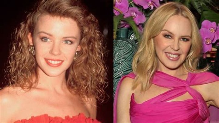 Uncovering The Truth Behind Kylie Minogue's Plastic Surgery Rumors