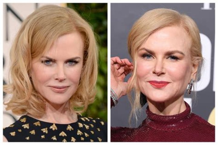 The Truth About Nicole Kidman's Plastic Surgery: Uncovering The Extent Of Her Procedures