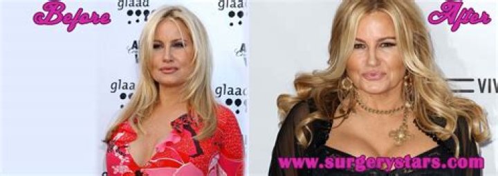 Unveiling Jennifer Coolidge's Breast Implants: Discoveries And Insights