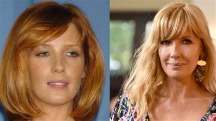 Unveiling The Truth Behind Kelly Reilly's Lip Transformation: A Journey Of Discovery