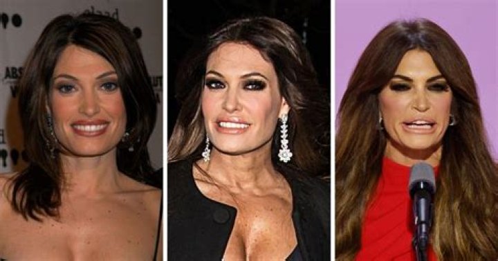 Kimberly Guilfoyle's Transformation: Before And After Photos Revealed