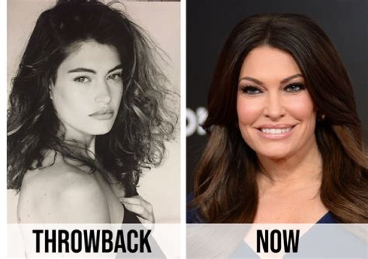 Kimberly Guilfoyle's Plastic Surgery Procedure: Before And After