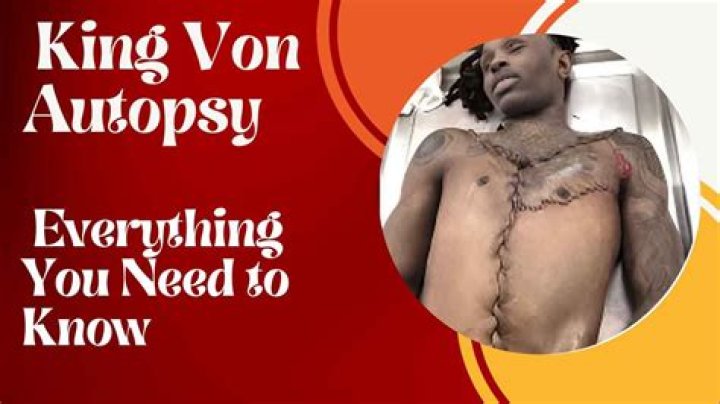 Unraveling The Mystery: King Von Body Autopsy