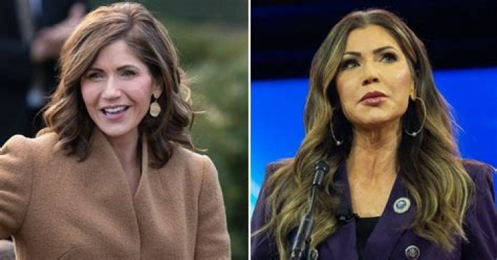 Governor Kristi Noem's Journey With Plastic Surgery: Transformation Uncovered