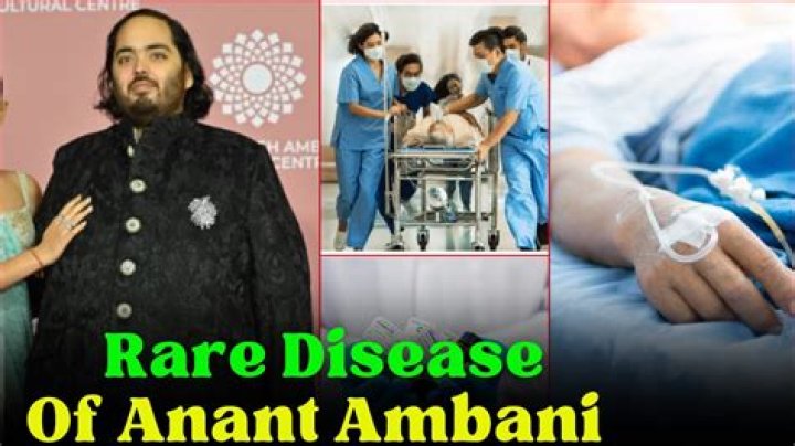 Mukesh Ambani's Health: Examining The Tycoon's Medical Condition
