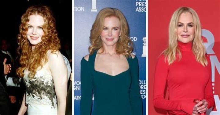 The Unbelievable Transformation Of Nicole Kidman: Before And After