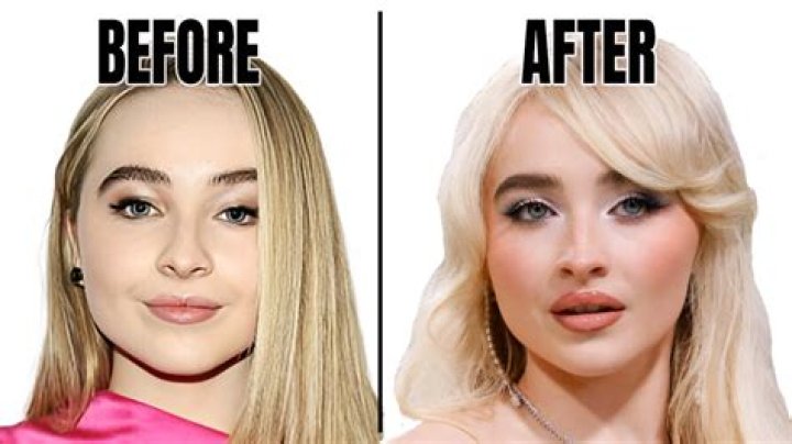 Unveiling The Evolution: Sabrina Carpenter's Face Change