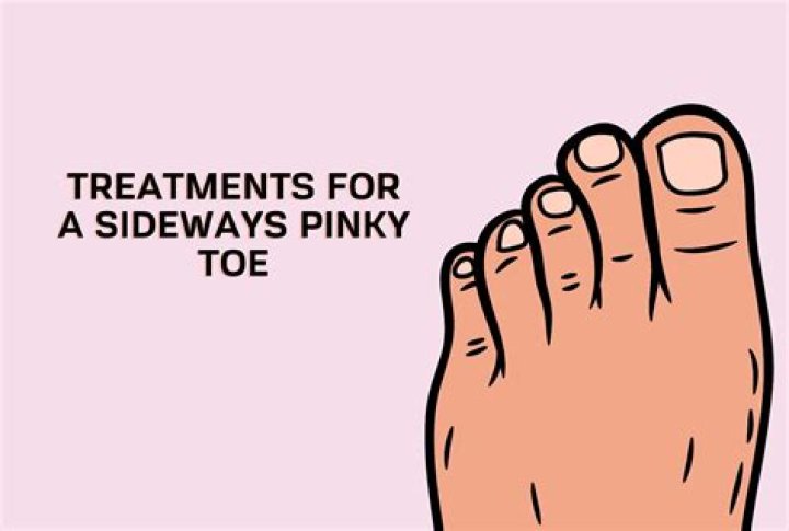 Embracing The Quirk: The Sideways Pinky Toe Phenomenon