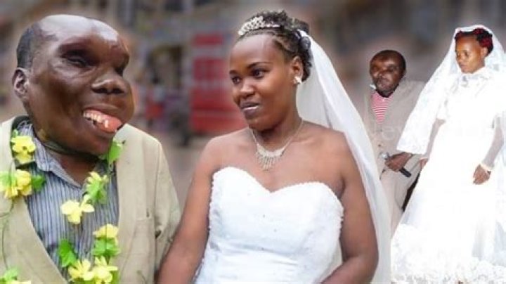 Unveiling The Truth Behind The "Ugliest Guy On Earth"