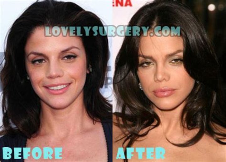Uncover The Truth Behind Vanessa Ferlito's Nose Job